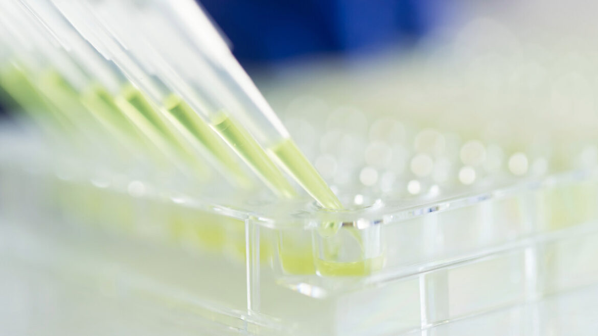 Exploring Advanced Treatments for Myelofibrosis